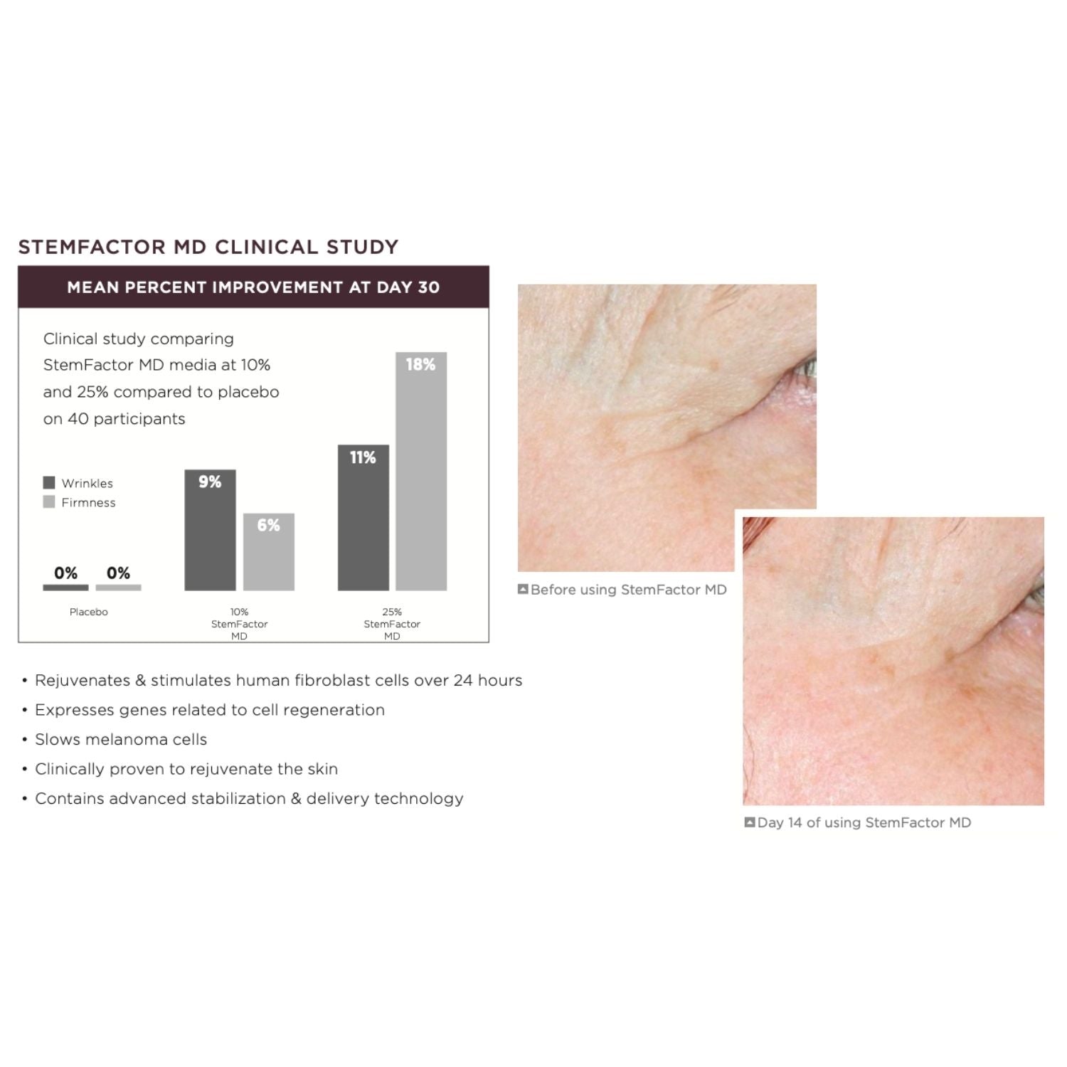 StemFactor MD clinical study results with before and after skin images and a bar graph.