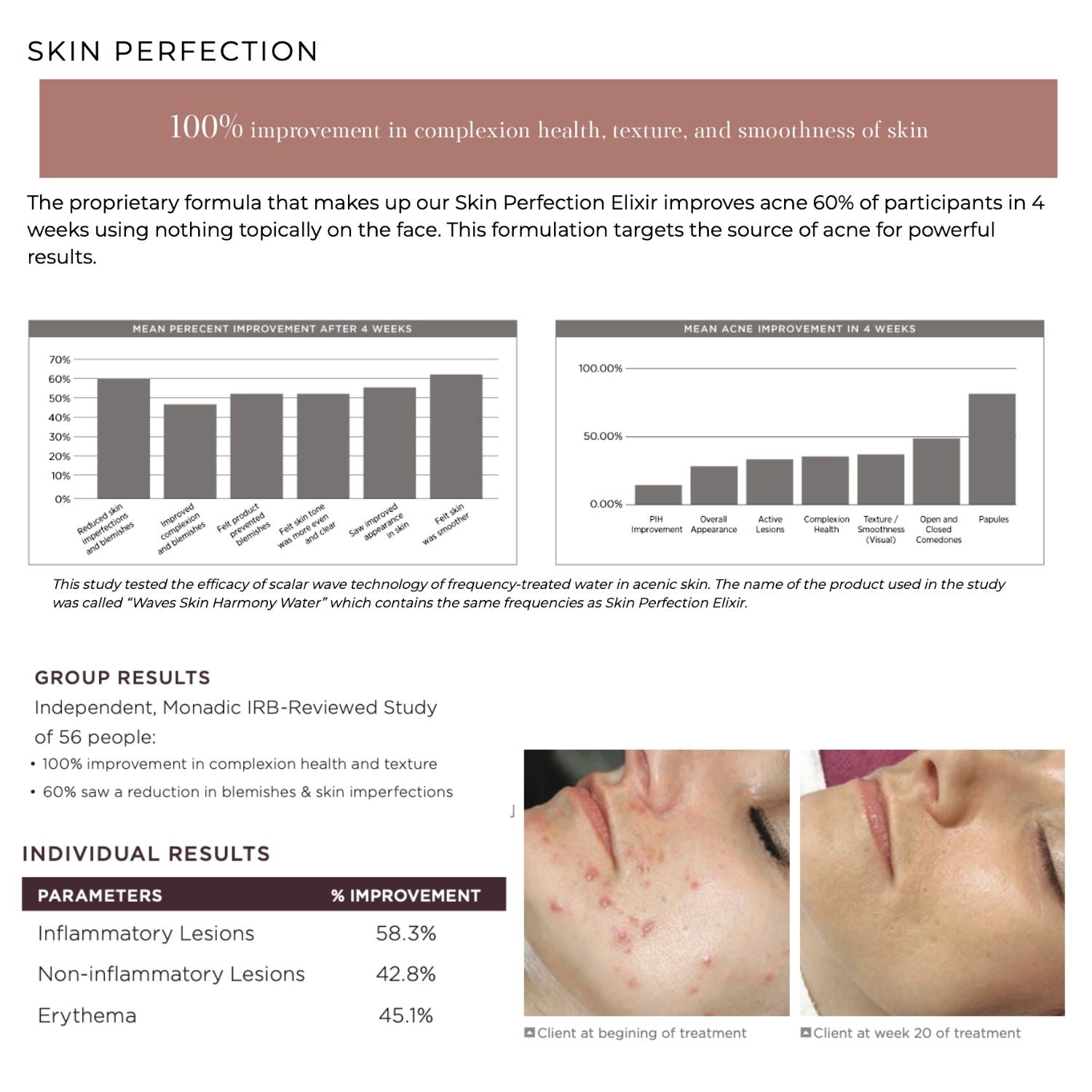 Clinical study infographic for Skin Perfection Elixir with before and after skin condition images and results